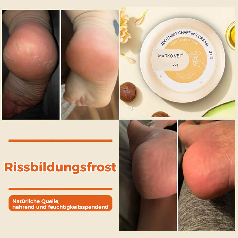 Rissfeste Creme für die Winterhaut