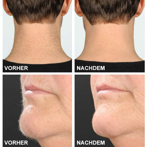 Schmerzfreier Augenbrauentrimmer
